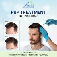 PRP Treatment in Hyderabad Prp with gfc treatment in Hyderabad
